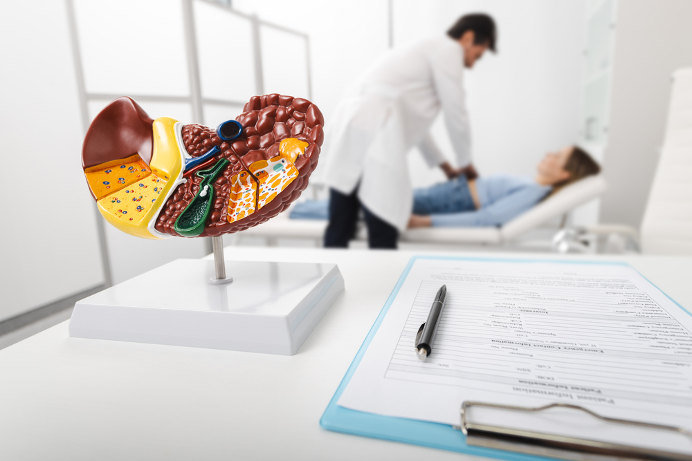 Escena clínica con modelo de hígado graso y evaluación médica de una paciente con posible esteatohepatitis no alcohólica